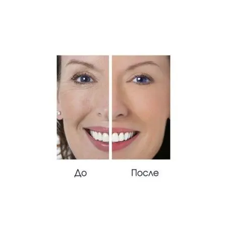 Вакуумный массажер для лица Gezatone Дреналифт фото в интернет магазине | zdorov.by