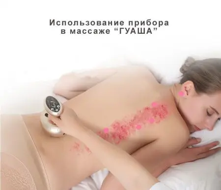 Аппарат вакуумного массажа с инфракрасным прогревом SHUXING SX-866B фото в интернет магазине | zdorov.by