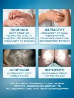 Лампа Аведерма от псориаза, витилиго и алопеции