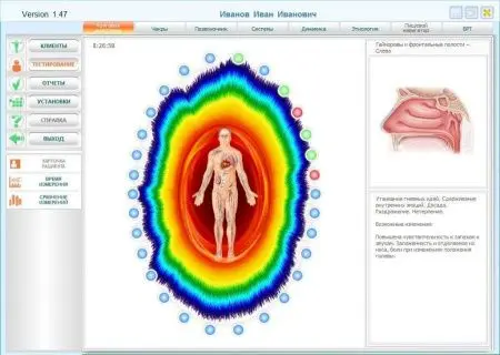 БРИС | BRIS - EXPRESS TEST фото в интернет магазине | zdorov.by