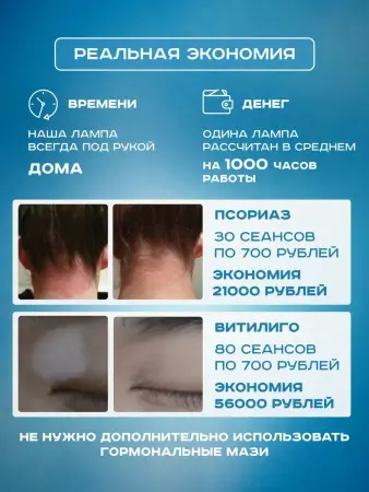 Лампа Аведерма от псориаза, витилиго и алопеции фото в интернет магазине | zdorov.by