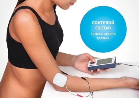 Аппарат нервно-мышечной стимуляции «Меркурий» фото в интернет магазине | zdorov.by