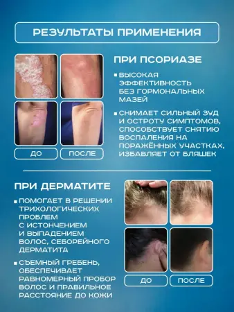 Лампа Аведерма от псориаза, витилиго и алопеции фото в интернет магазине | zdorov.by