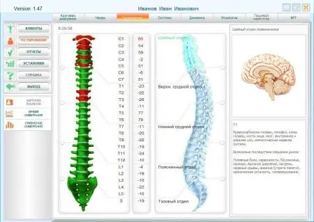 БРИС | BRIS - EXPRESS TEST фото в интернет магазине | zdorov.by