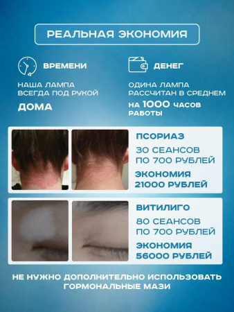 Лампа Аведерма от псориаза, витилиго и алопеции фото в интернет магазине | zdorov.by